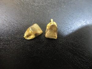 大吉 武蔵小金井店 金歯の画像です。