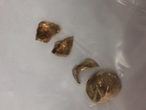 中野区周辺で金歯を売るなら買取専門店大吉中野店へ!!