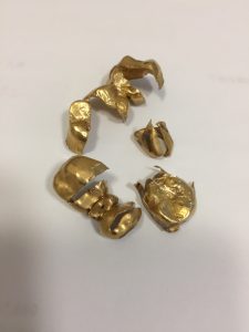 金歯の買取も!大吉松戸店にお持ちください!