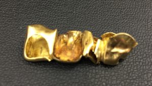 金歯を買取ました!福岡県久留米市にある買取専門店大吉久留米店です(^^)/