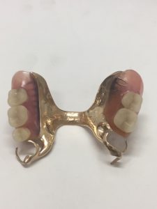 金歯,買取,那覇