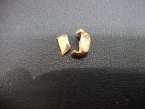 金歯の買取なら大吉和光店へ!