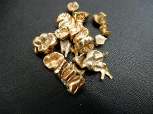 金歯買取松山市