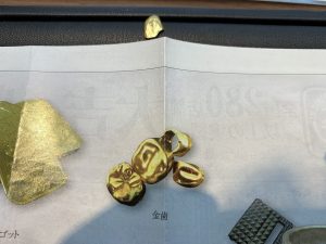 貴金属は何もアクセサリーとは限りません。金歯ももちろん対象！姶良市・買取専門店大吉タイヨー西加治木店はレベルが違います。