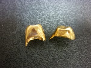 奈良県 金歯 買取 王寺