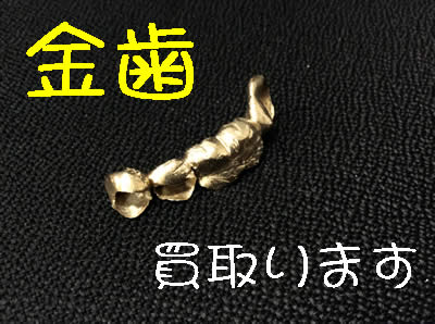 買取 京都 金歯