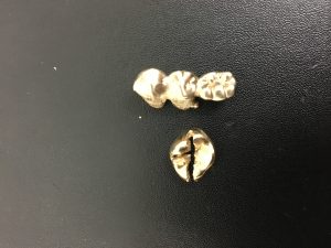 東灘 金歯 買取 甲南山手