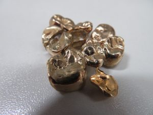 買取専門店大吉尼崎店では金歯のお買取りさせて頂きます。