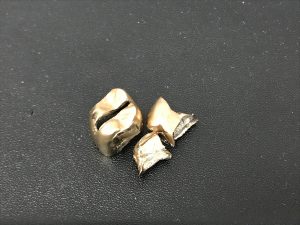 東灘 金歯 買取 甲南山手