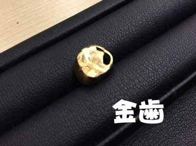 金歯の買取も大吉フレンドマート宇治店にお任せください♡