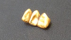 【金歯】もお買取出来ます(^^)!買取専門店 大吉 イオンタウン仙台泉大沢店✧