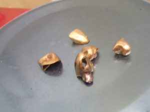 金歯をお買取!大吉ゆめタウン八代店