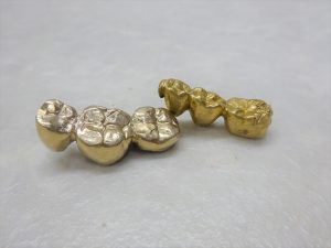 豊田市の金歯・金製品買取は、大吉豊田店にお任せください★