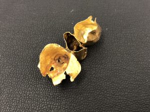 外れた金歯は大吉綾瀬タウンヒルズ店でお買取りいたします!