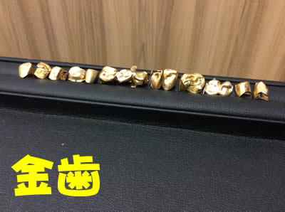 金歯も買取ます(´っ・ω・)っ大吉フレンドマート宇治店