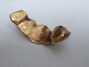 買取専門店大吉ゆめタウン中津店(大分県)で、金歯もお買取りいたします!!