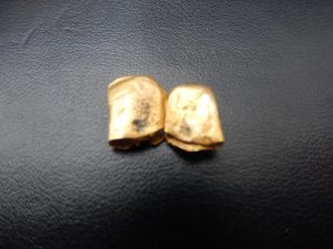 金歯買取鶴見店鶴見駅そば-1