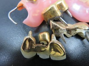 歯付きの金歯もお買取しております!買取専門店大吉 キッピーモール三田店へ♪