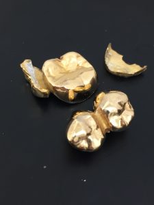 金歯の買取もしています。買取専門店大吉アピタ宇都宮店です