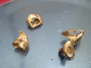 金歯をお買取!大吉ゆめタウン八代店