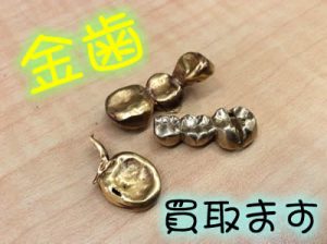 買取　京都　金歯