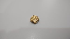 金歯の買取なら大吉和光店へ！