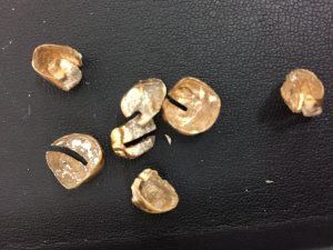 大府市,買取,金歯,