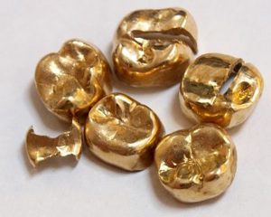 金歯　貴金属　眼鏡　メガネ　買取　買い取り　東京都　江戸川区　葛西