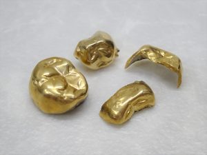 豊田市の金歯買取は、大吉豊田店にお任せください★
