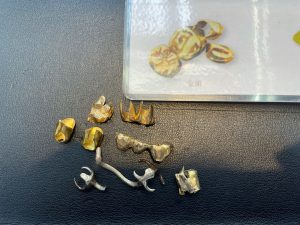 ポロっと出てきた金歯や銀歯等々…良いんです！そのまんま姶良市・買取専門店大吉タイヨー西加治木店へお持ち込み下さい！