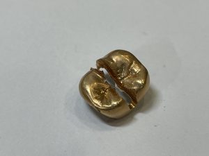 大吉国立店で金歯をお買取りしました!!