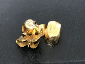 東灘 芦屋 金歯 金製品 買取 甲南山手 大吉