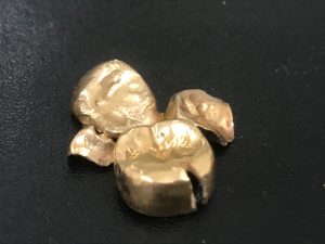 東灘 芦屋 金歯 金製品 買取 甲南山手 大吉