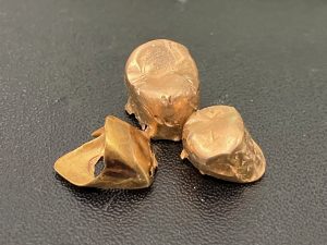 東灘　芦屋　金歯　金製品　買取　甲南山手　大吉