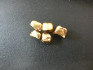 金歯を買取専門店大吉JR八尾店でお買取しました。JR八尾駅すぐ。平野、加美、志紀、布施、東大阪。