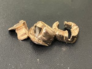 東灘 芦屋 金歯 金製品 買取 甲南山手 大吉