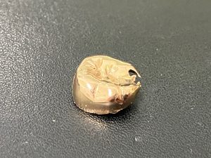 東灘　芦屋　金歯　金製品　買取　甲南山手　大吉