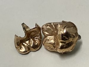 東灘　芦屋　金歯　金製品　買取　甲南山手　大吉