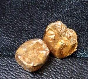 金歯,横須賀,買取