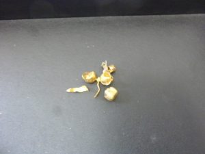 買取専門店大吉八尾店に金歯をお持ちいただきました。平野、志紀、東大阪、布施、柏原、瓢箪山、加美、八尾。