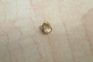 金歯をお買取いたしました♪歯科金属を売るなら大吉ゆめタウン八代店へ!