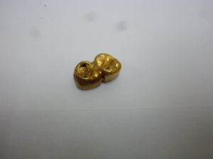 買取大吉八尾店に金歯をお持ちいただきました。平野、志紀、東大阪、布施、柏原、瓢箪山、若江岩田。