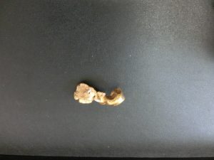 買取大吉八尾店へ金歯をお持ちください。平野、志紀、東大阪、布施、柏原、若江岩田、瓢箪山。