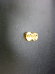 買取大吉八尾店へ金歯をお持ちください。平野、志紀、東大阪、布施、柏原、若江岩田、瓢箪山、藤井寺。