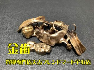 金歯,買取,宇治