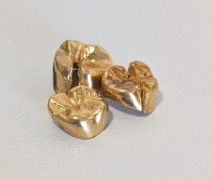 金歯,茅ヶ崎,買取