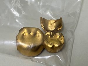 東灘 芦屋 金歯 金製品 買取 甲南山手 大吉
